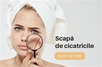 Știai că petele maronii, cicatricile post-acnee și chiar ridurile faciale pot fi tratate prin peelingul chimic?