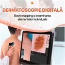 Dermatoscopie digitală